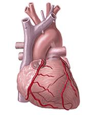 Arritmia Cardiaca